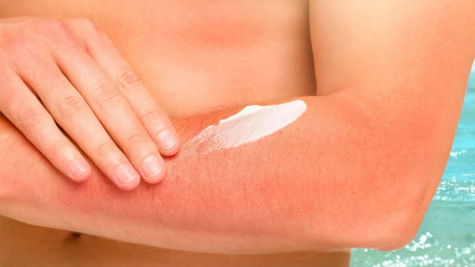 Safe-Pain-Relief-Cream-for-Sensitive-Skin-Featured-Image